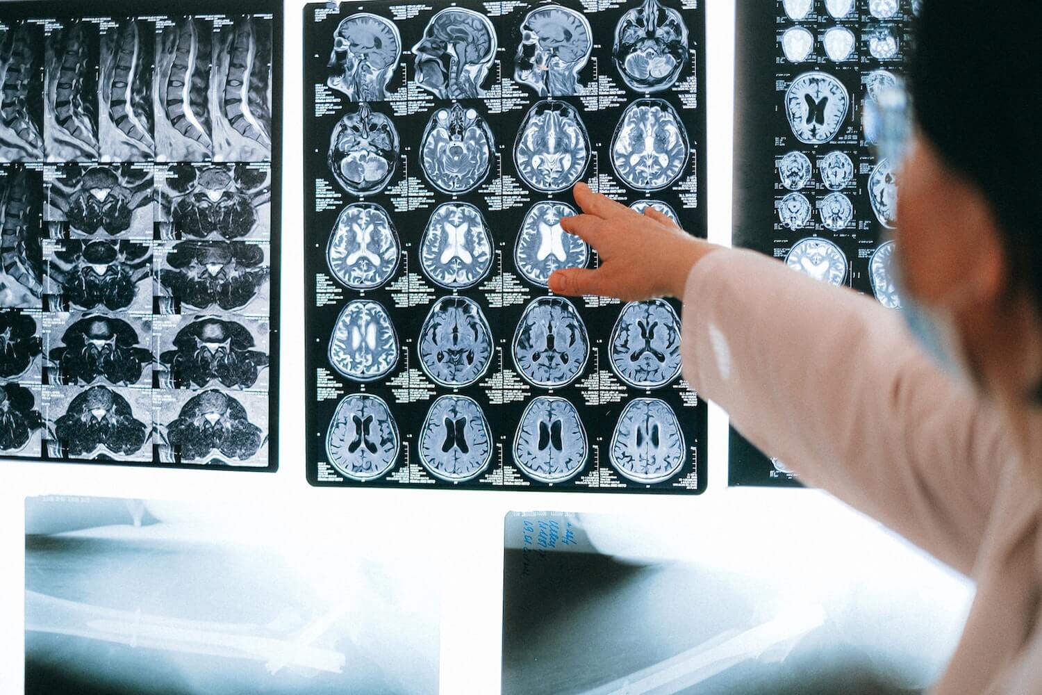 You are currently viewing Telemedicine Neurology: A Stroke of Genius